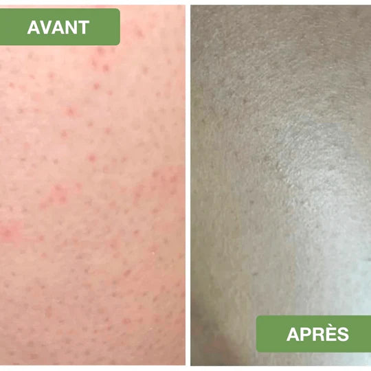 Gant Exfoliant