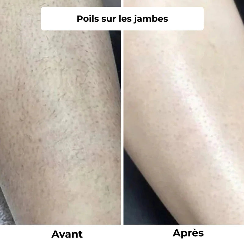 Jambes