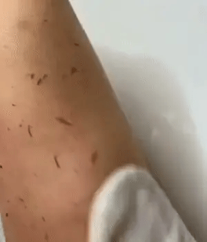 Gant Exfoliant