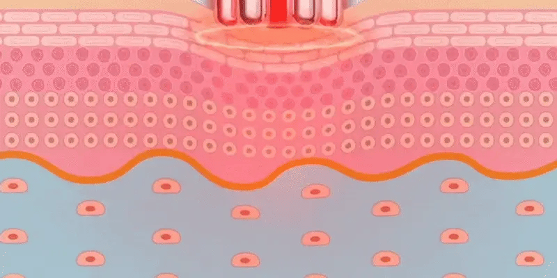 Alt Image