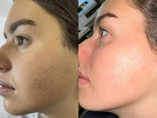 Sophie M. — Cliente vérifiée
