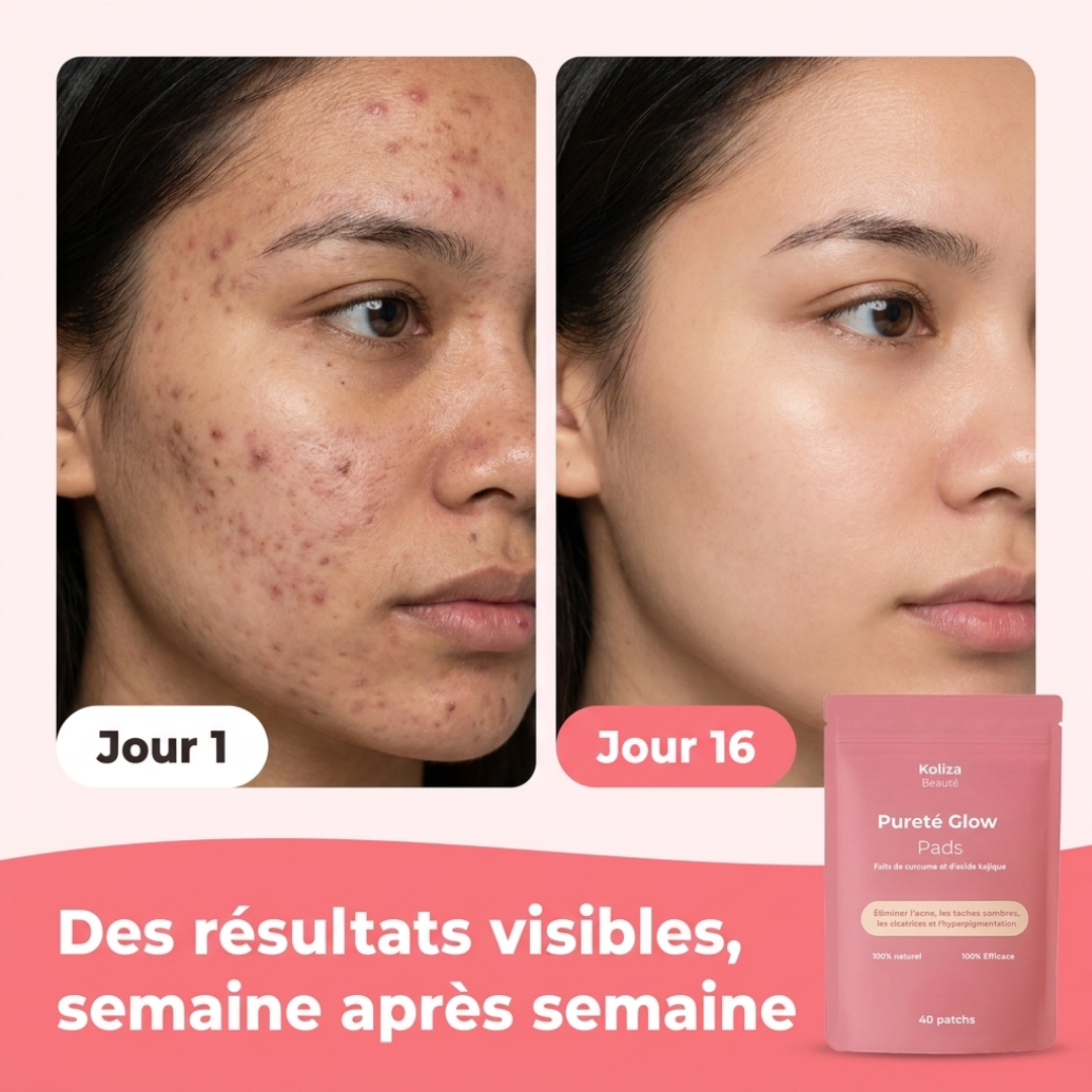 Patchs Pureté Glow 4.0 – Pour une peau lisse, pure et éclatante