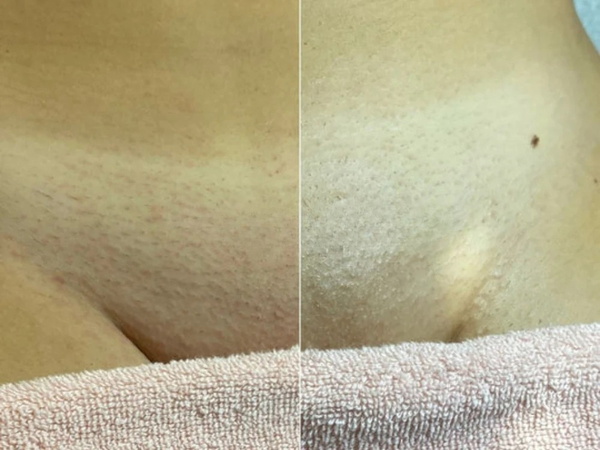 Karine B. — Cliente vérifiée