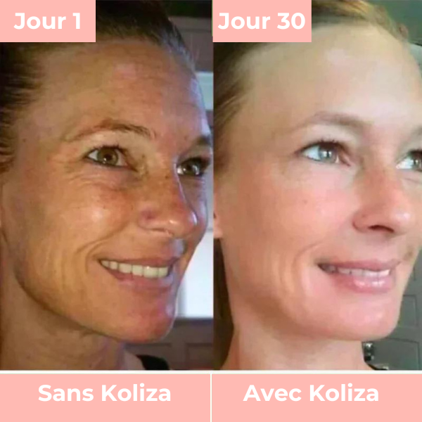 Masque LED Pour Visage | Koliza