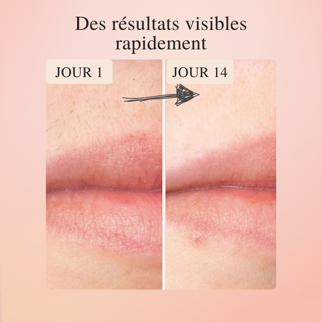 Koliza - IPL Epilator