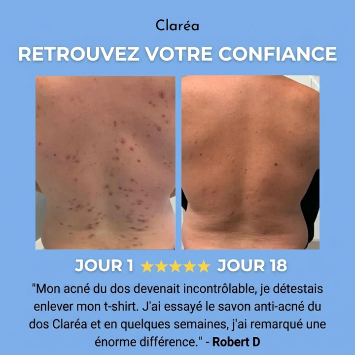 Claréa - Savon anti-acné