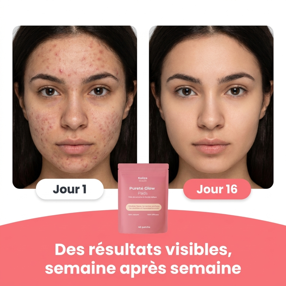 Patchs Pureté Glow 4.0 – Pour une peau lisse, pure et éclatante