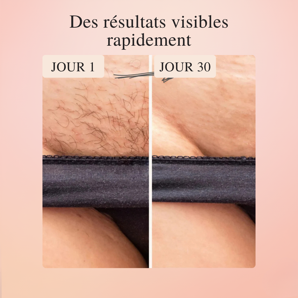 Koliza - IPL Epilator