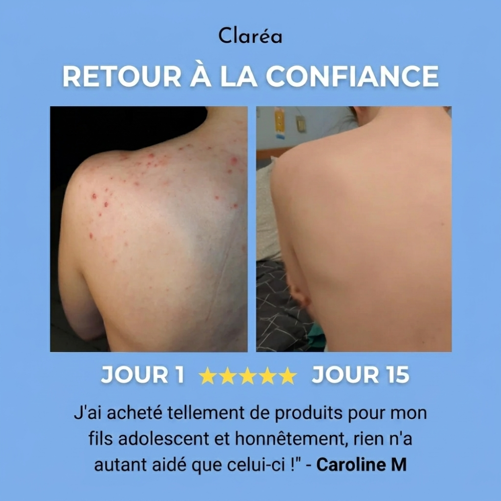 Claréa - Savon anti-acné