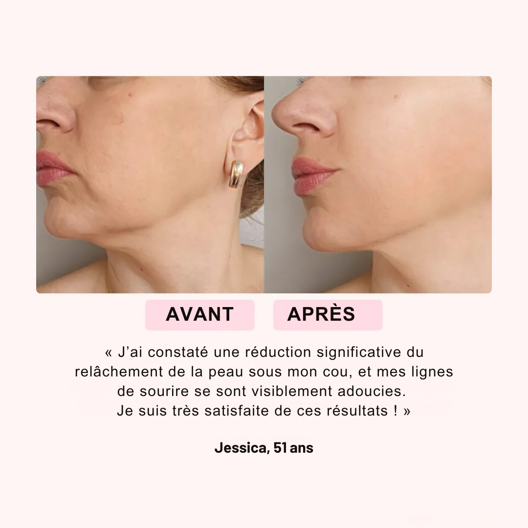 Koliza™ 2.0 – Masque LED Rajeunissant Visage & Cou