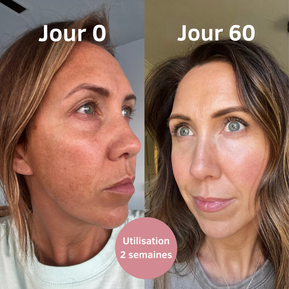 SKINOVA - Masque Collagène pour le Visage