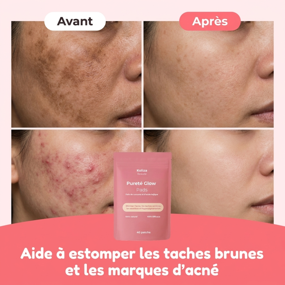 Patchs Pureté Glow 4.0 – Pour une peau lisse, pure et éclatante