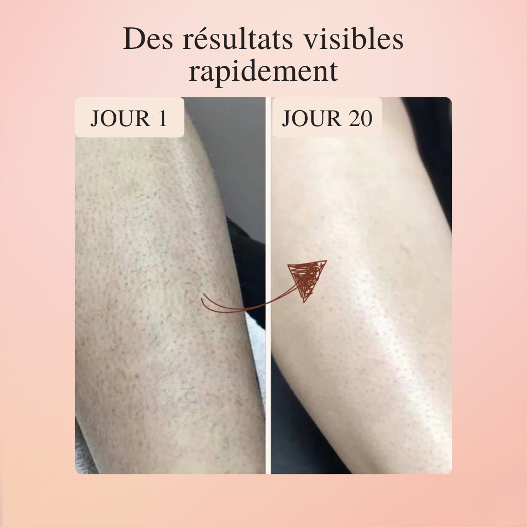 Koliza - IPL Epilator