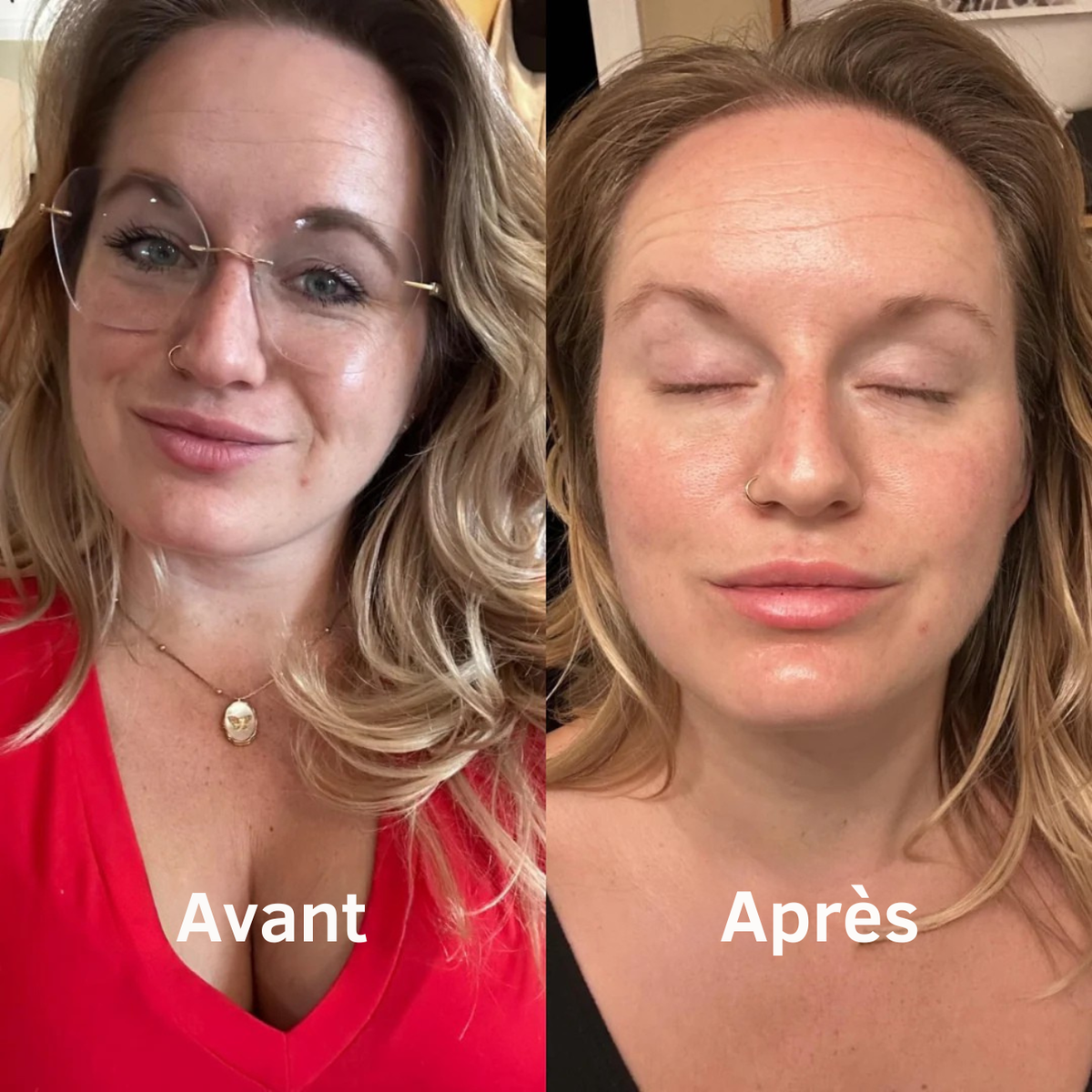 Masque Bio Skinova - Masque Collagène pour le Visage