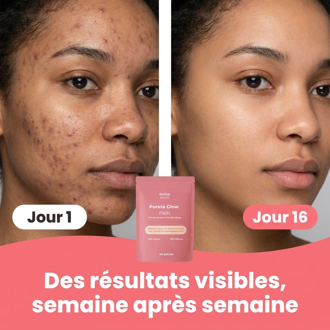Patchs Pureté Glow 4.0 – Pour une peau lisse, pure et éclatante