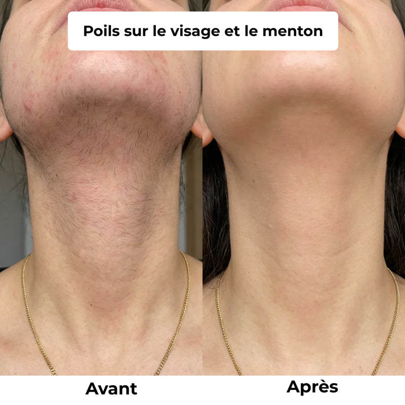Visage