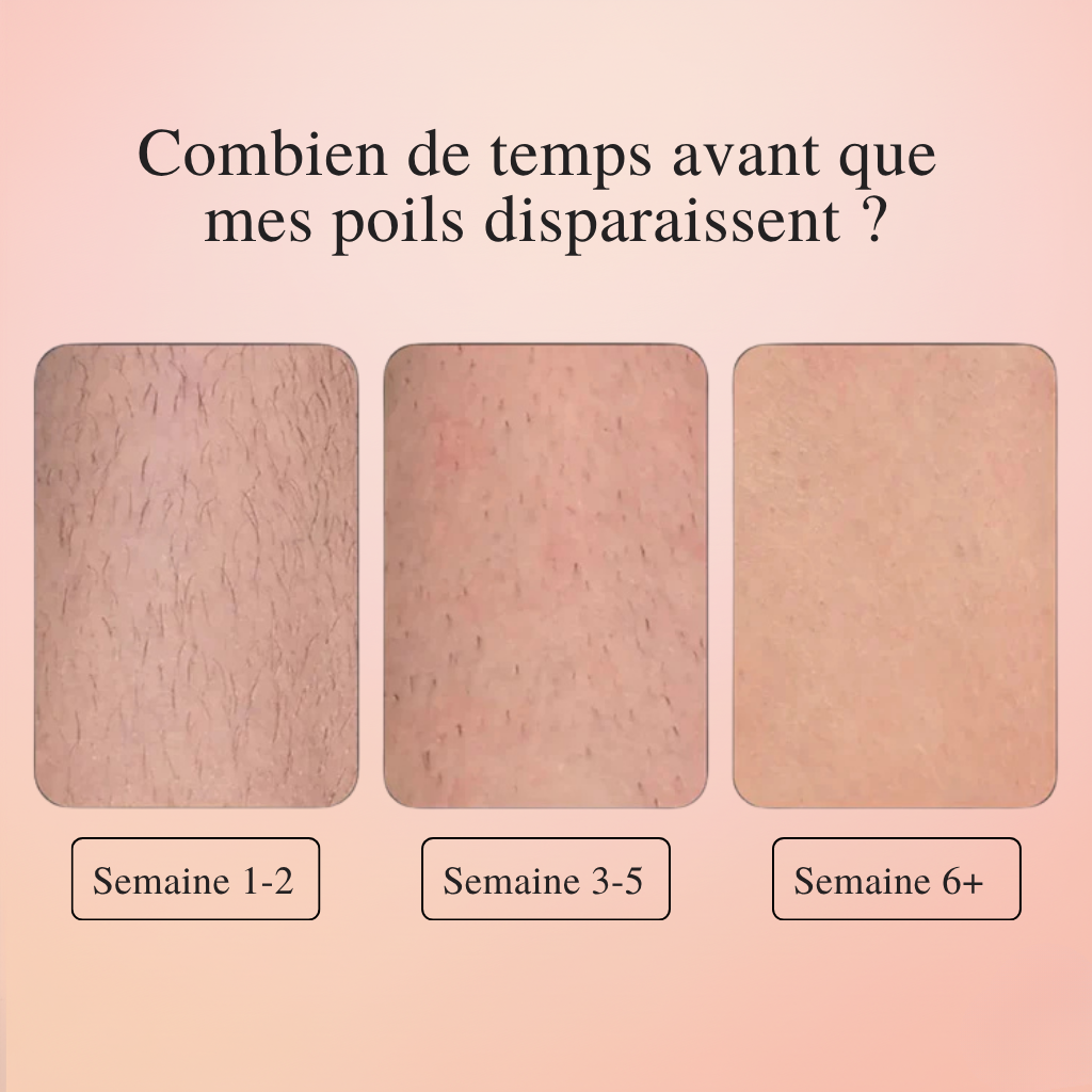 Koliza - IPL Epilator