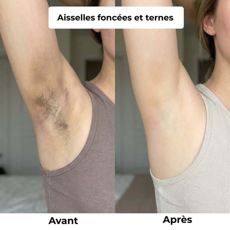 Aisselles