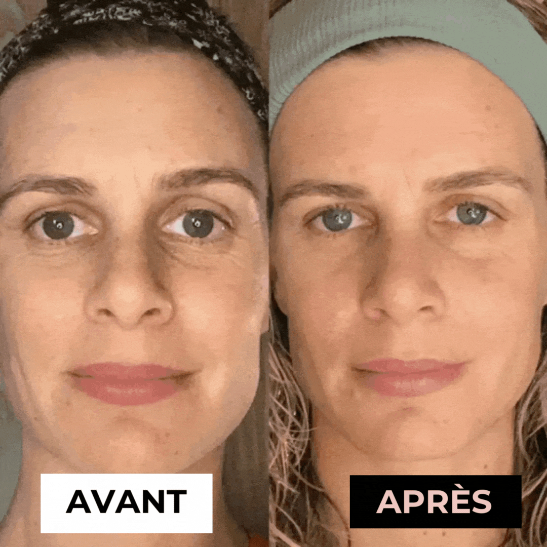 Masseur Noreska | Anti-acné et Anti-rides – Koliza Québec