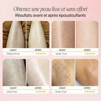 Le Rasoir Électrique Skinova 2.0